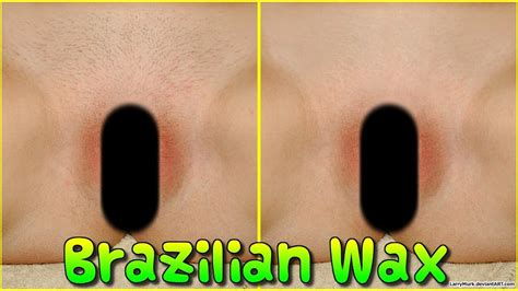 video of brazilian wax hair removal
